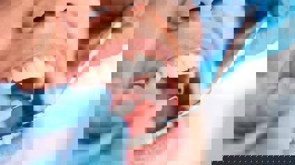 Woman Having Dental Check Up