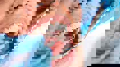 Applying the Texture Analyser to the dental industry: Compression, flexure and extrusion