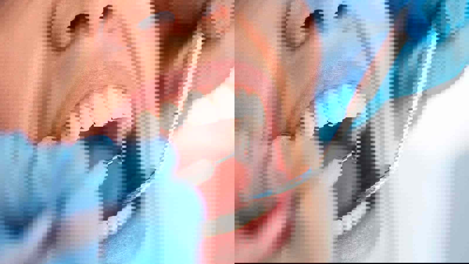 Person having a dental examination