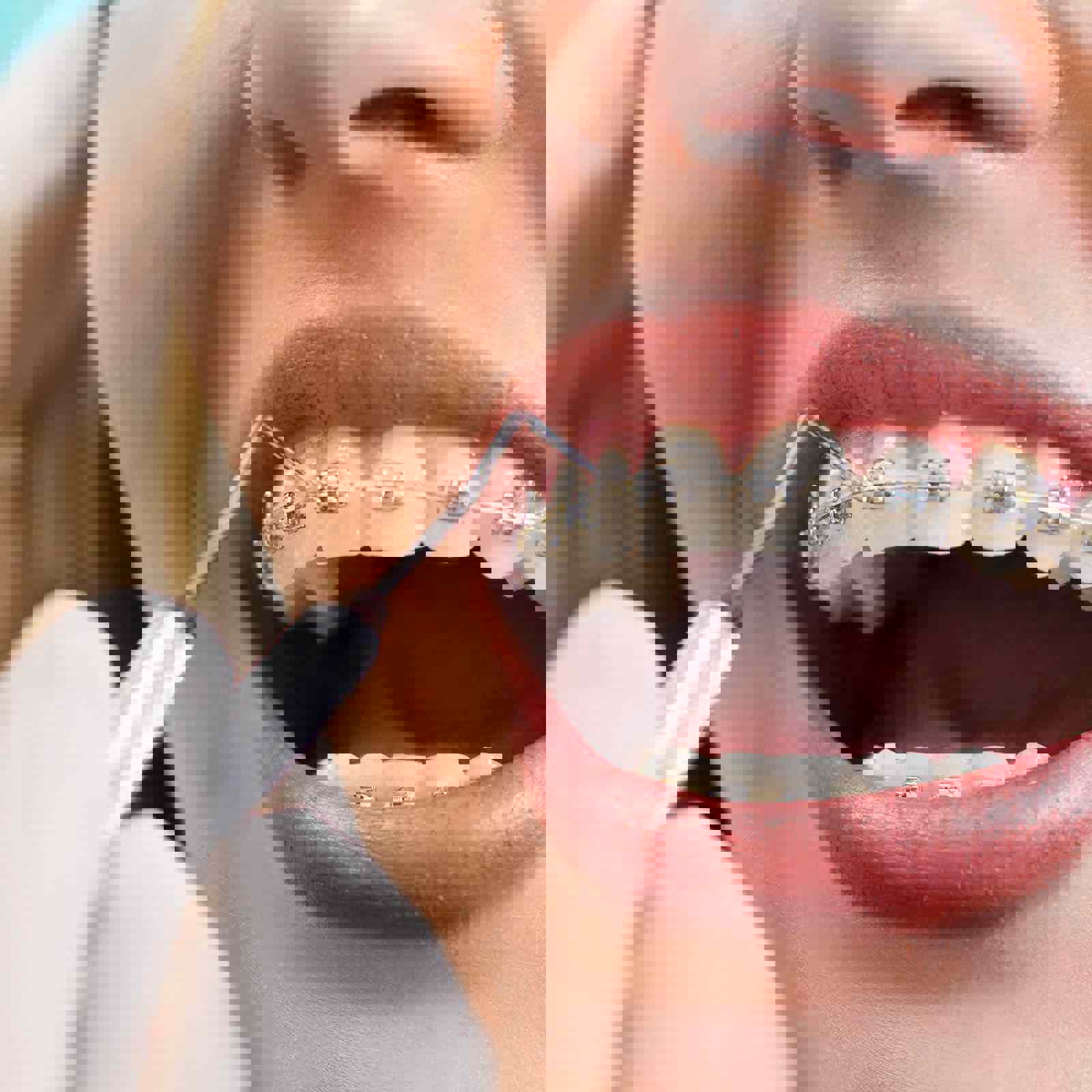 Person with braces being examined by orthodontist