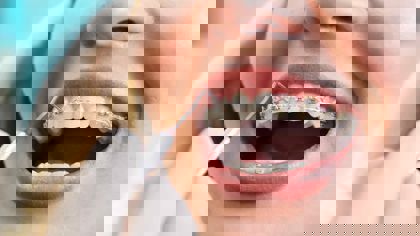 Dental products: The application of texture analysis on the latest developments