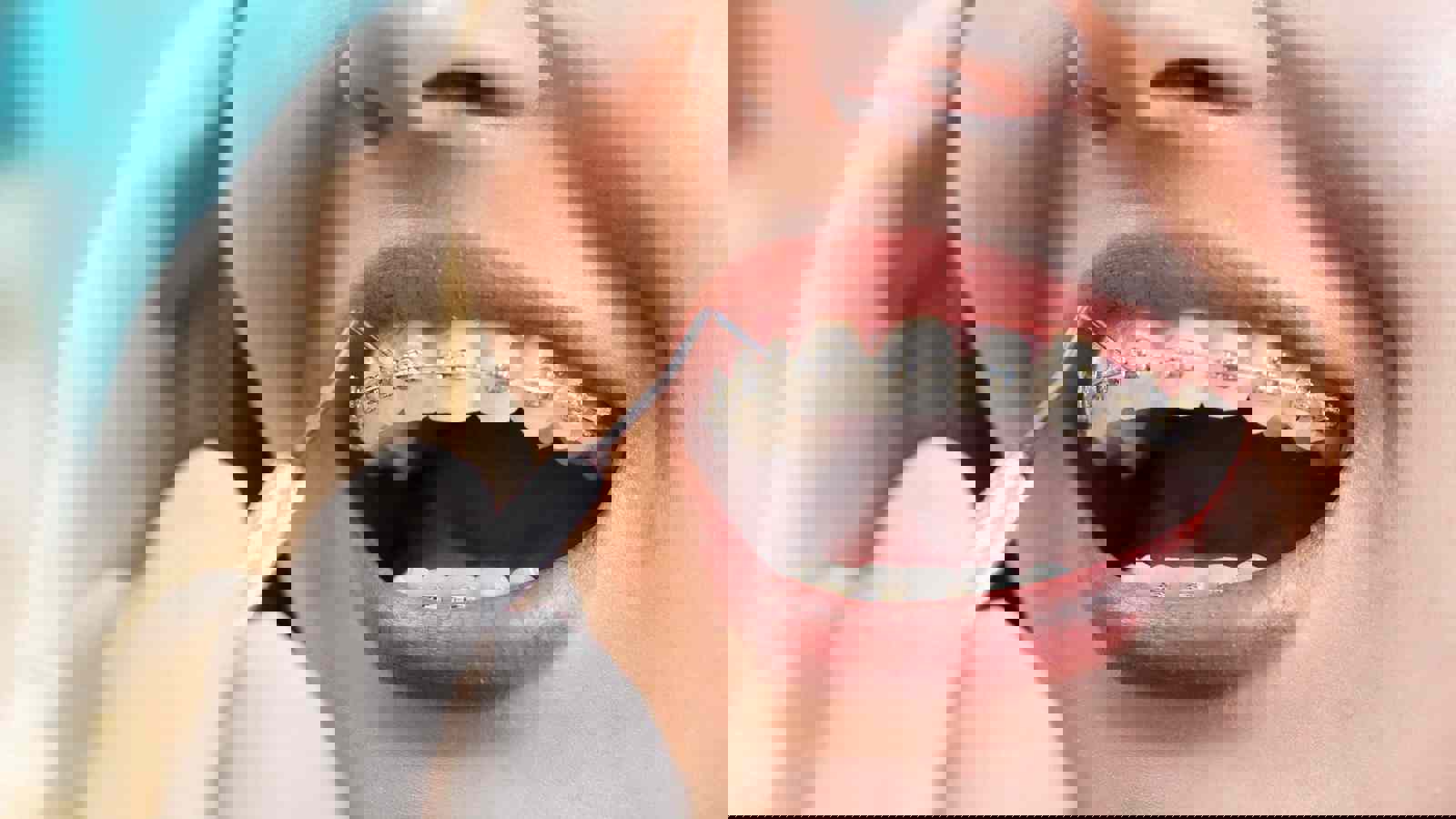 Person with braces being examined by orthodontist 