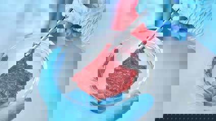 Scientist Holding Petri Dish Containing Cultured Meat Sample