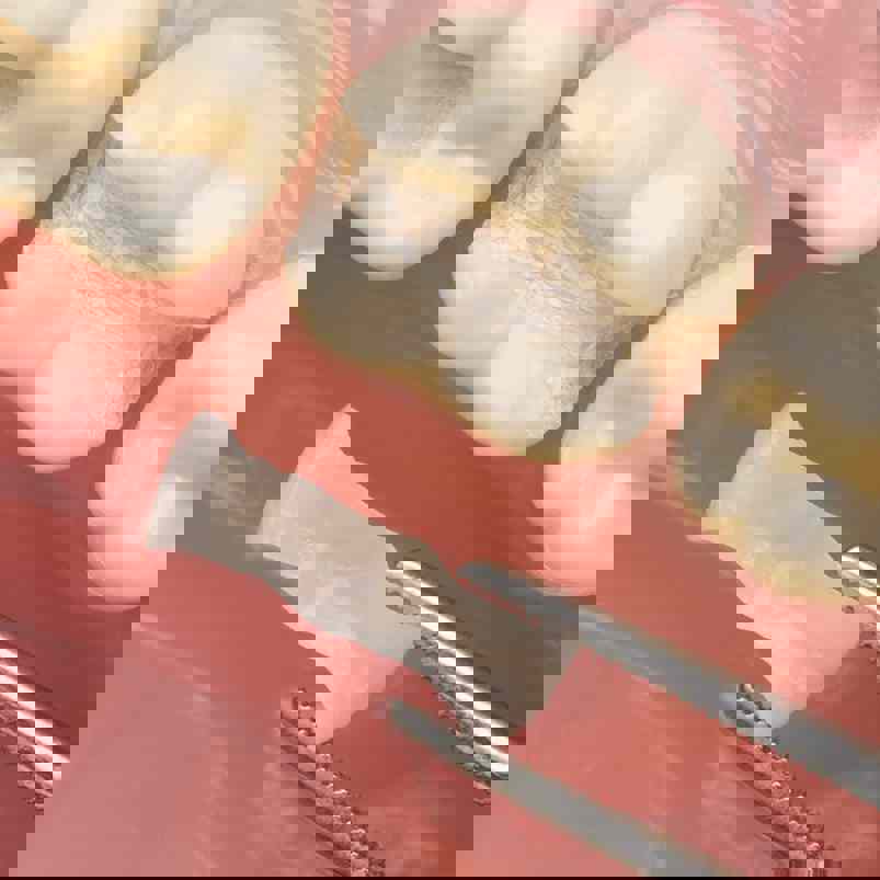 Dental filler ready to be inserted