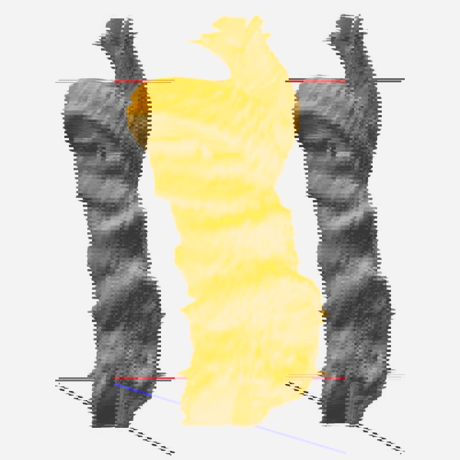 Volscan Profiler Curl Scan